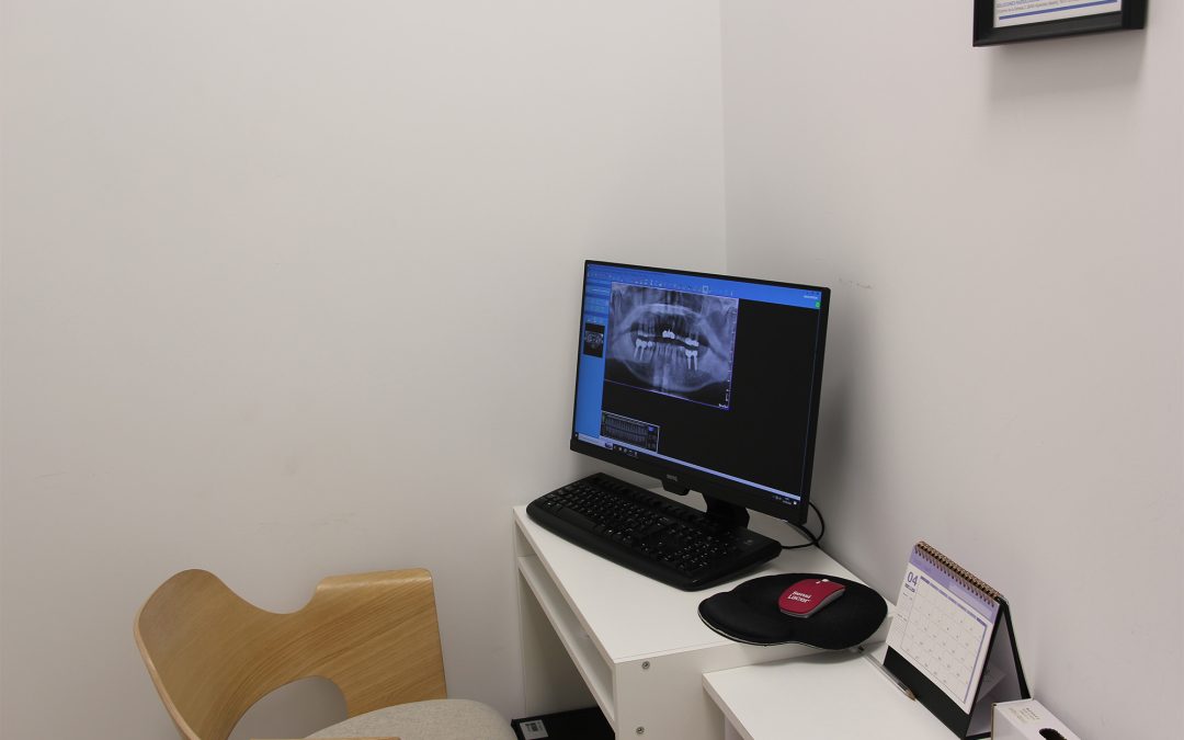 Rehabilitación oral completa: recupera la función, la estética y la confianza en tu sonrisa